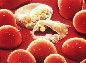Malaria parasite consumes the red blood cells
