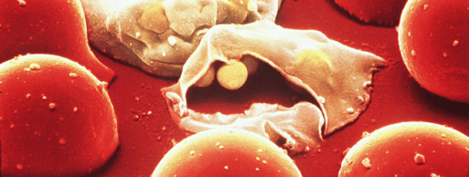 Malaria parasite consumes the red blood cells